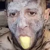 glumemd