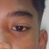 kepinnwid12