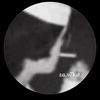 mn9o6n