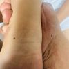 me491690