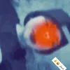 kihgtfde0