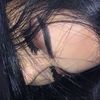 anur_289
