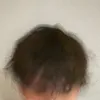 kimian_zero