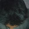 albar9155