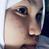 refayunidamayanti