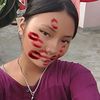 prathana.mgrx