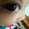 bingchiling202