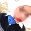 2_na4h