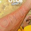 damol100