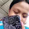 rose.kulit