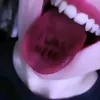 gi__hp