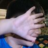 dlh_dabest