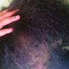 prettylightskin0509