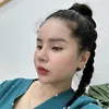 tiemfillerbotoxdanang_