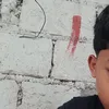 itlognipide0