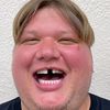 im_p1mple