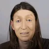 felcatudo