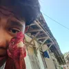 wong.mumet939