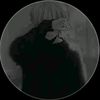 fazly036