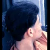 dacro30