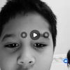 immatoe_