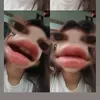 dabip371