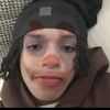 aubrey_bri