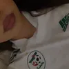 l3.y418