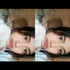 dynxnn