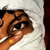 ahamadaglere1