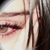 userx.died1