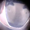 adj18