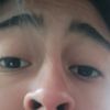 bolita_clinica