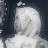 merii_key5