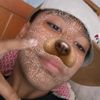 axelitopexs
