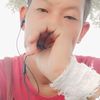 myo.gyi52557