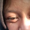 lufianazarinadpib_