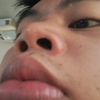 zekmg