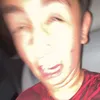 jonaswithupsyndrome