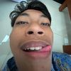 blntong