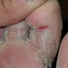 AnthonyAthletesfoot