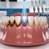 Ai Teeth Clean
