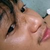 dirmlbb2
