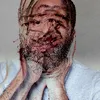 stddnlprz