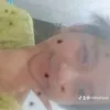 miklahpat