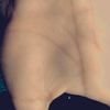 zay861176