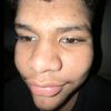 mylesrvsdyq