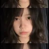 Răng cửa dỗi nhau 😭