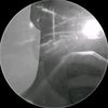 dinka.rif