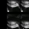 lona121001
